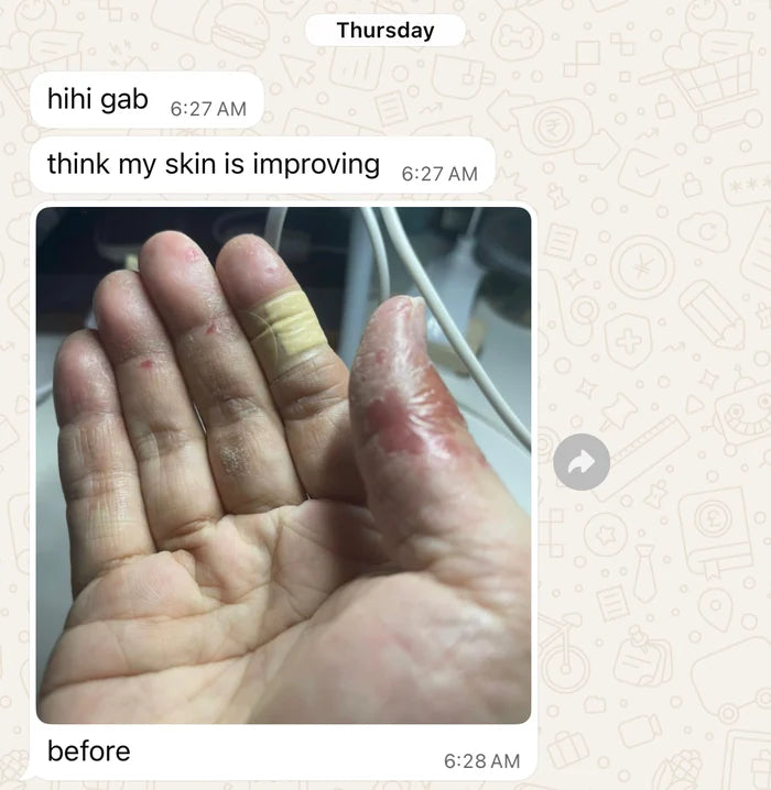 Amiela WhatsApp: before photo of her hand