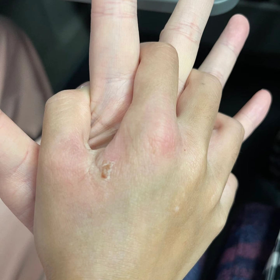 Your skin steadies