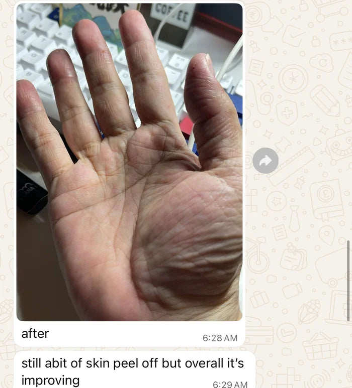 Amiela WhatsApp: after photo of her hand