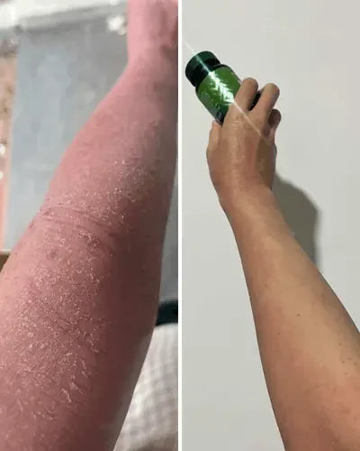 Customer before and after