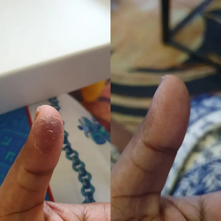 Customer fingertip, before and after