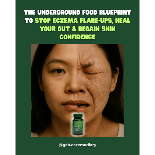 Anti - Flare Diet Guide - MakeHealth - Easier