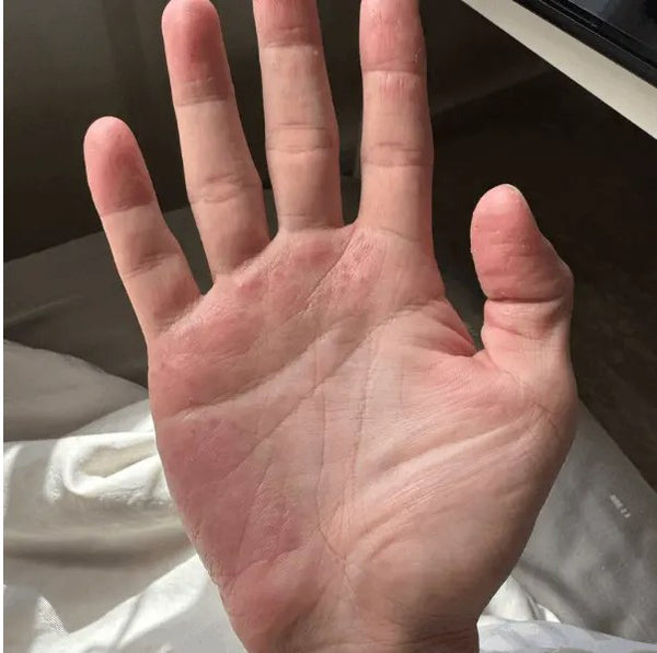 After 90 days on SpiroPlus — calm palm