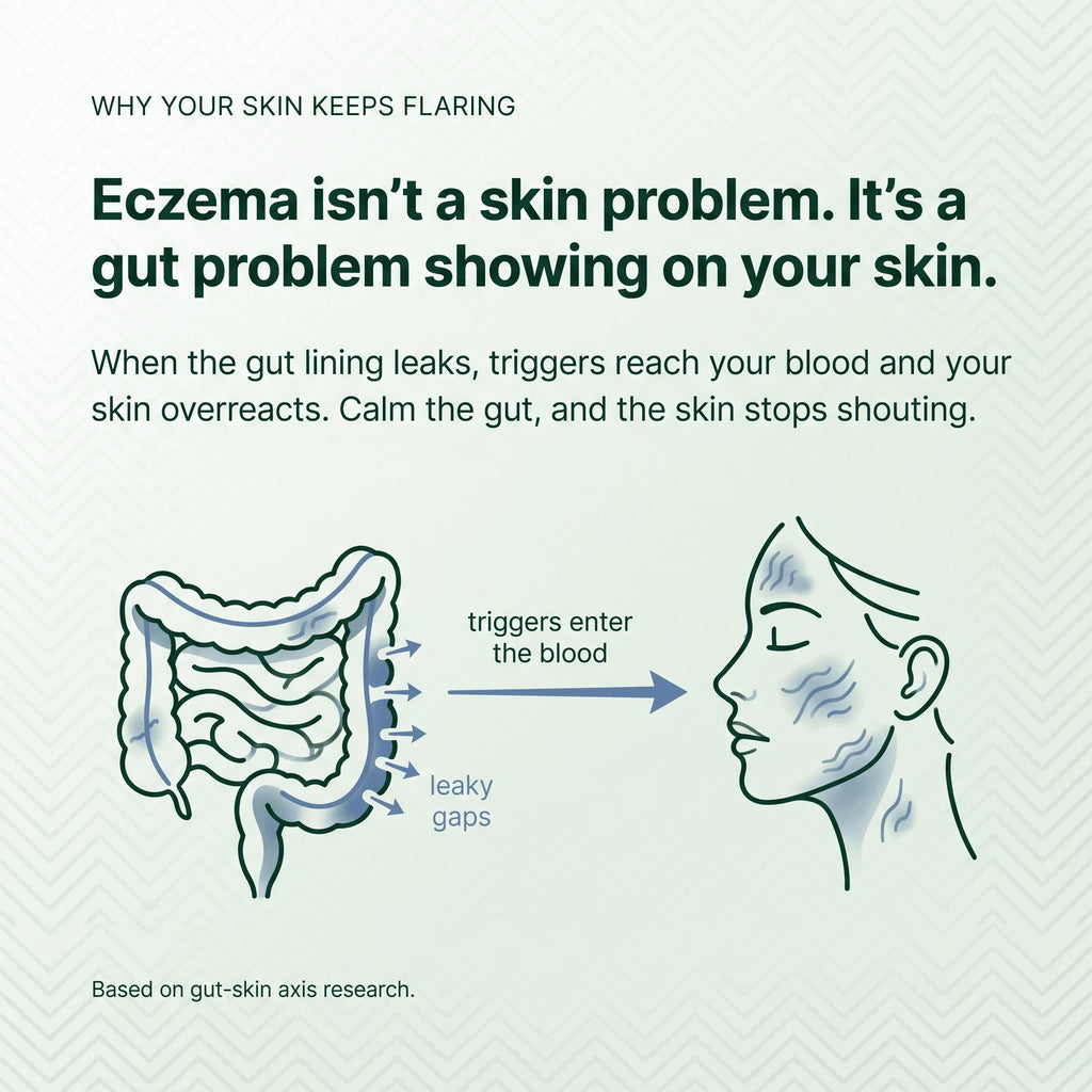 SpiroPlus (Eczema Solution Backed by Gut Science) - MakeHealth-Easier