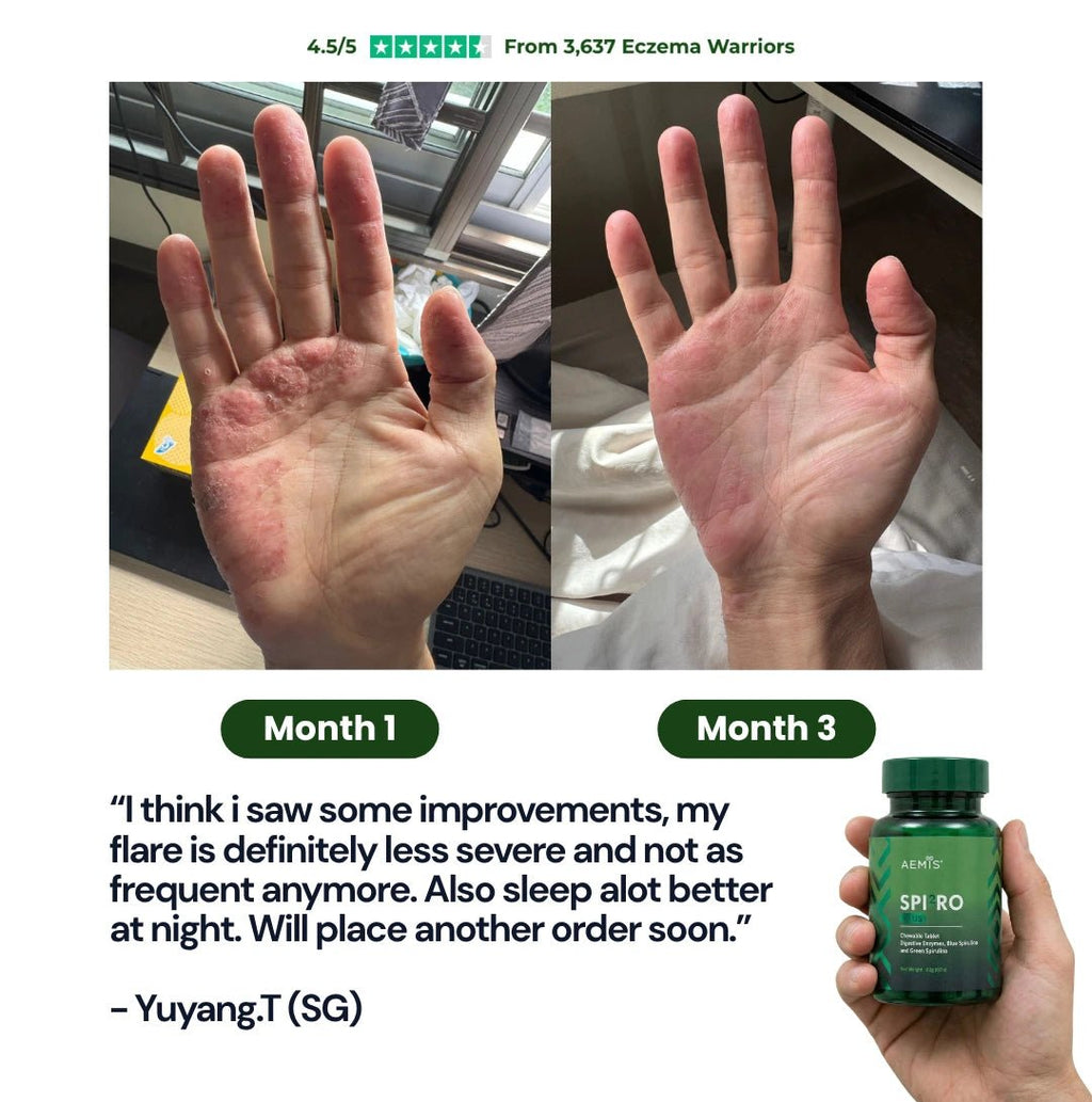 SpiroPlus (Eczema Solution Backed by Gut Science) - MakeHealth - Easier