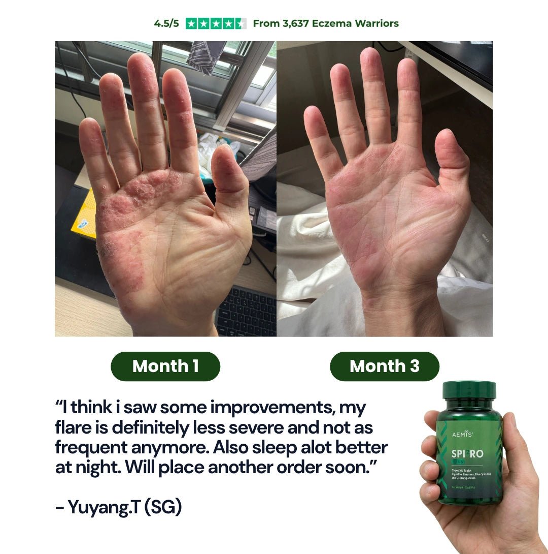 SpiroPlus (Eczema Solution Backed by Gut Science) - MakeHealth - Easier