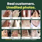 SpiroPlus (Eczema Solution Backed by Gut Science) - MakeHealth-Easier