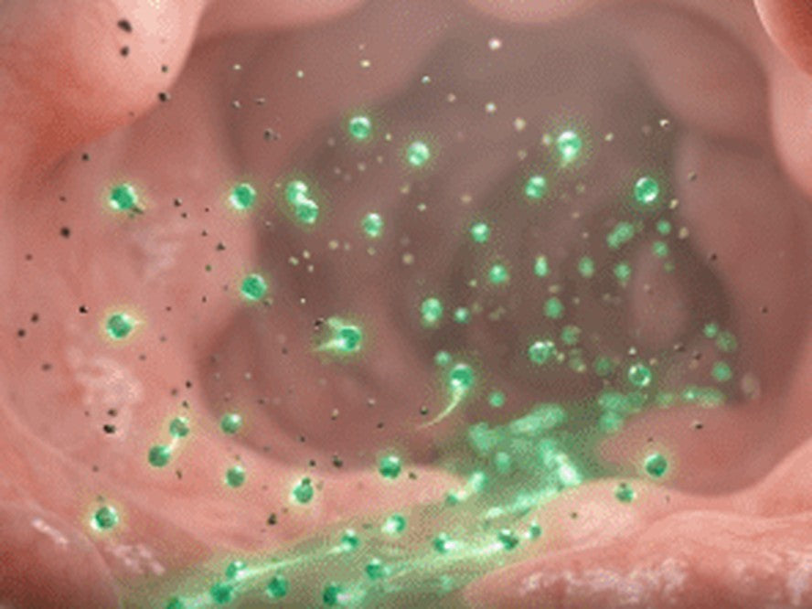 Detox: chlorella clearing what gets through