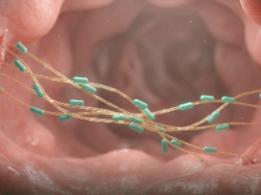 Repair: prebiotic fibre feeding the gut lining